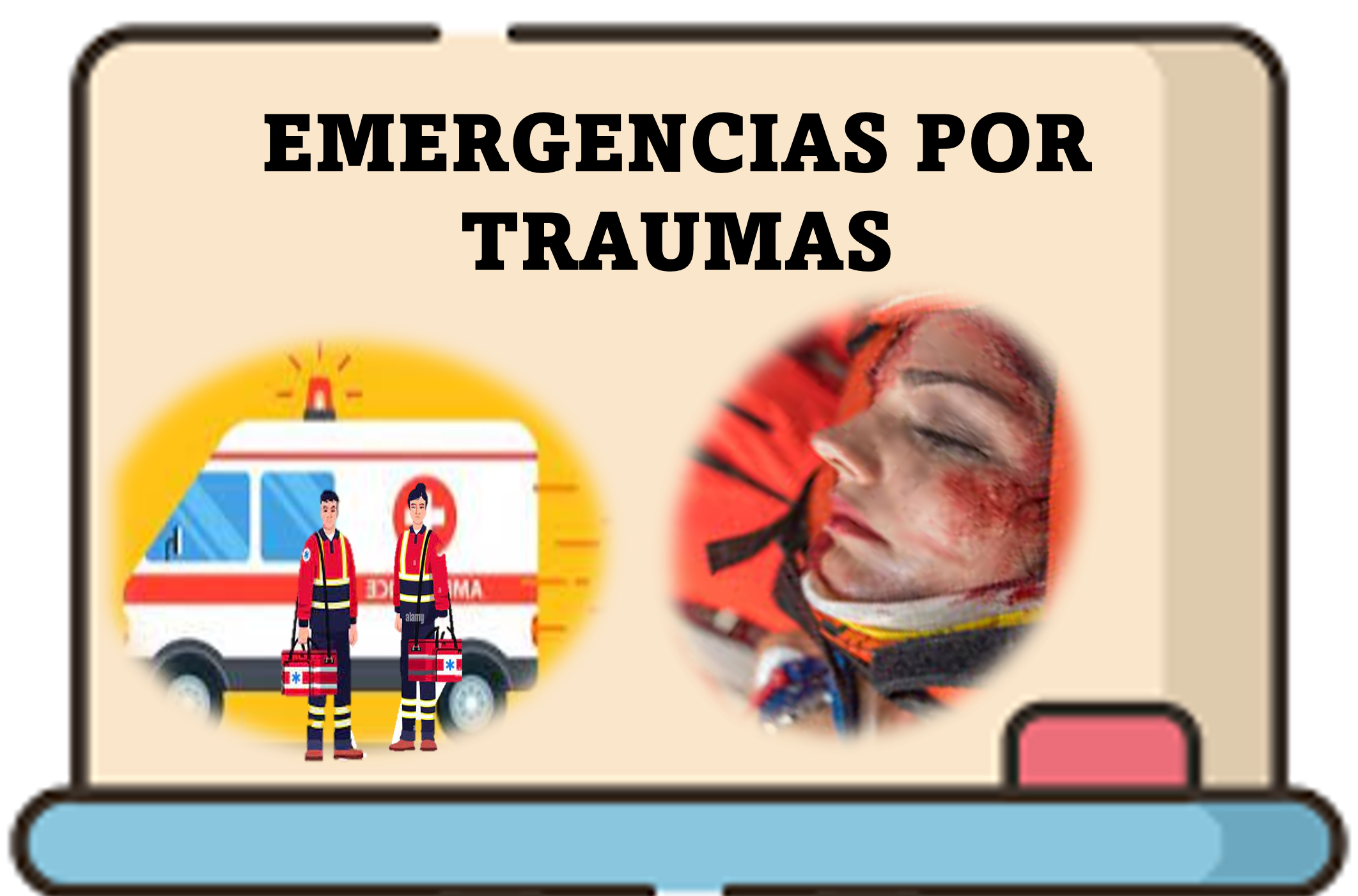 03PAR_EMT-EMERGENCIAS POR TRAUMAS