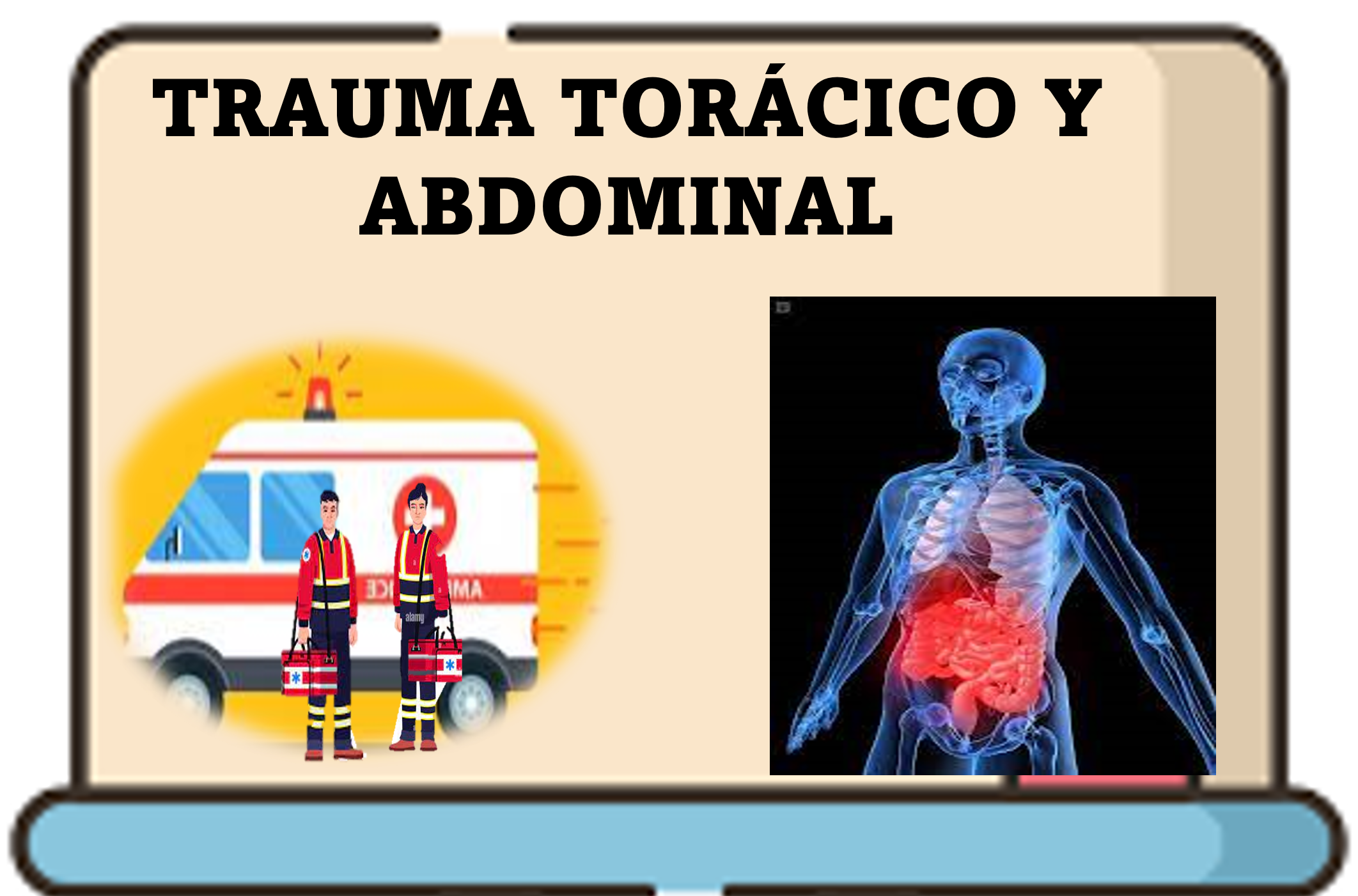 APH2023_TRA-TRAUMA TORÁCICO Y ABDOMINAL 