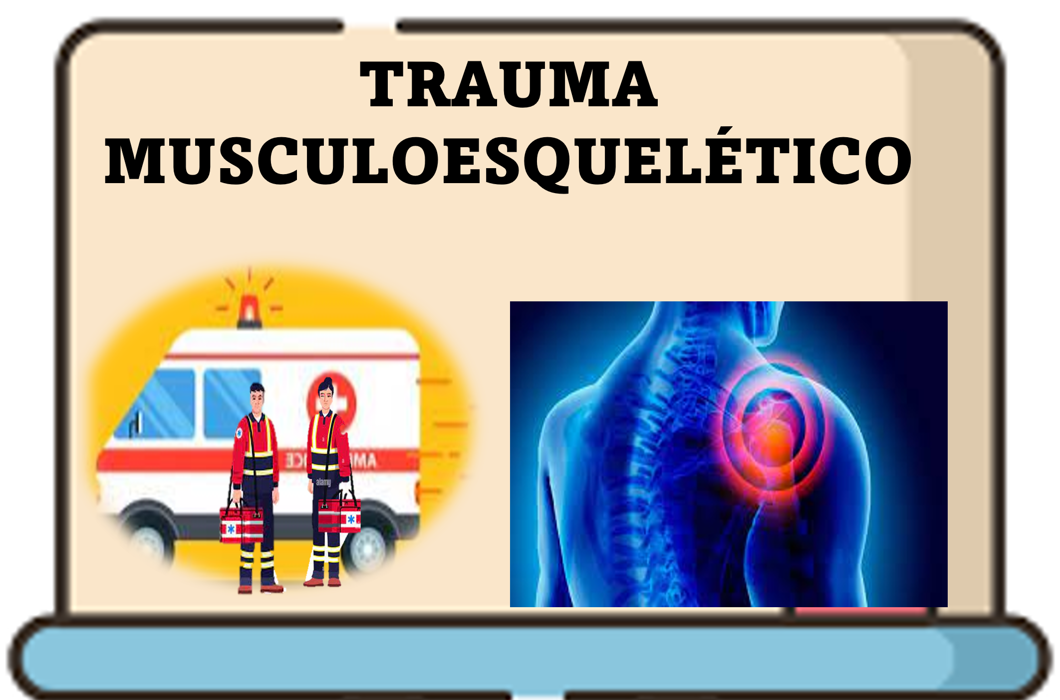 APH2023_TME-TRAUMA MUSCULOESQUELÉTICO